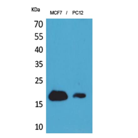 Western Blot - Anti-IFITM1 Antibody (C30521) - Antibodies.com