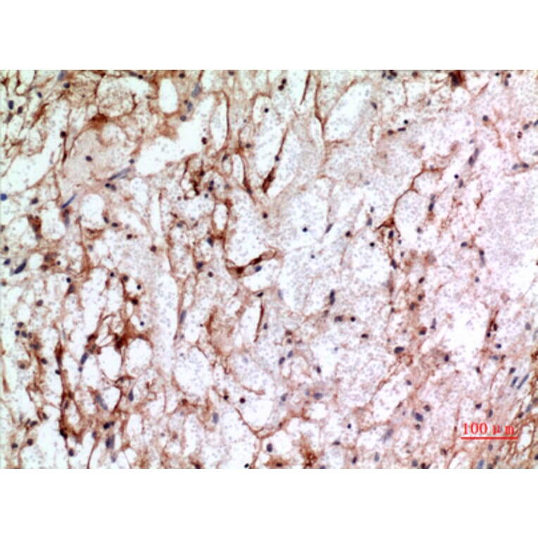 Immunohistochemistry - Anti-IFITM1 Antibody (C30521) - Antibodies.com
