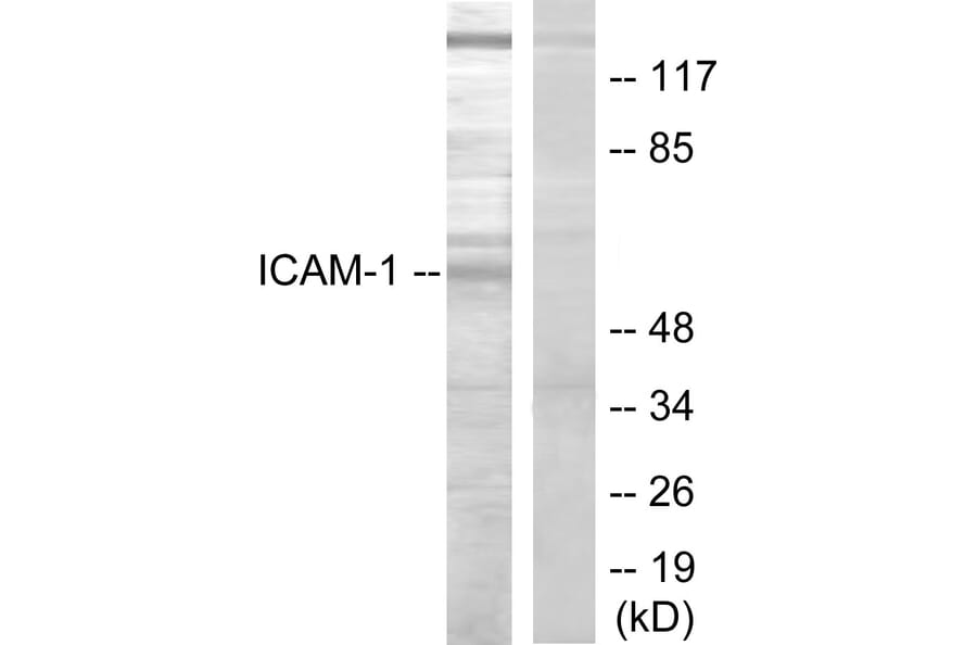 Western Blot - Anti-ICAM-1 Antibody (B7113) - Antibodies.com