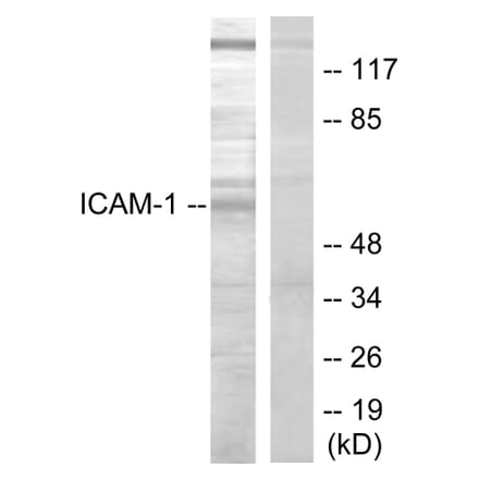 Western Blot - Anti-ICAM-1 Antibody (B7113) - Antibodies.com