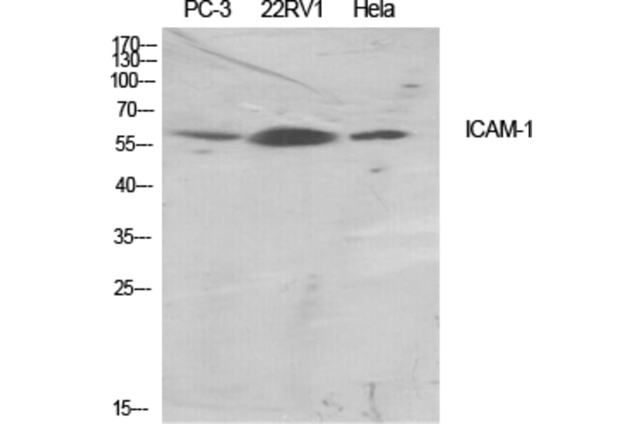 Western Blot - Anti-ICAM-1 Antibody (B7113) - Antibodies.com