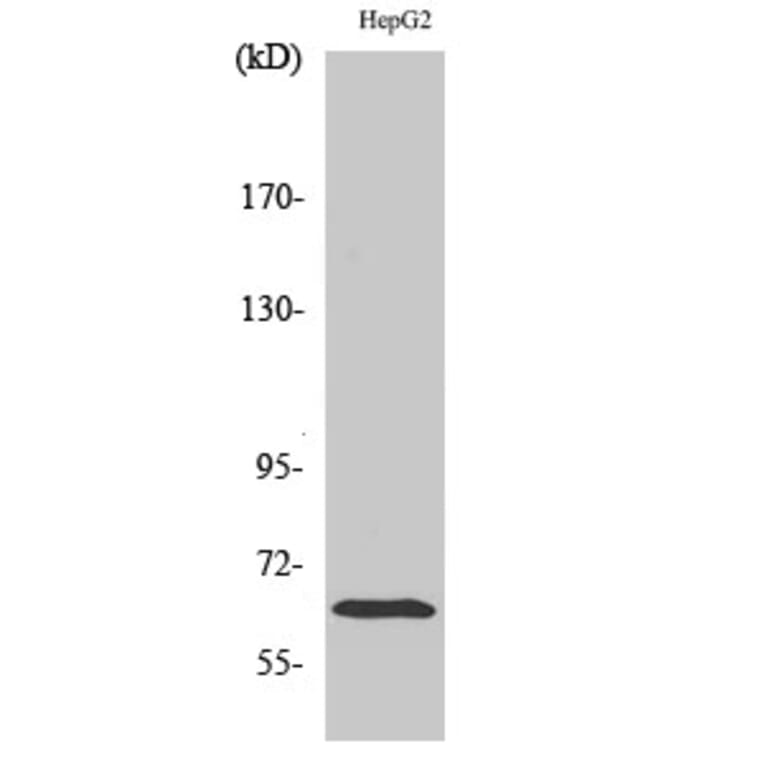 Western Blot - Anti-ICAM-1 Antibody (B7113) - Antibodies.com