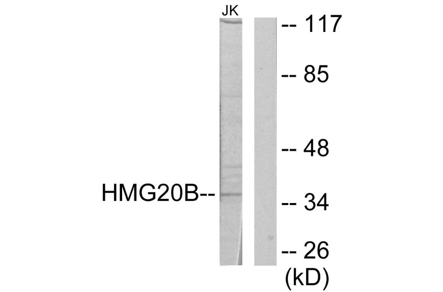 Western Blot - Anti-HMG20B Antibody (C11798) - Antibodies.com