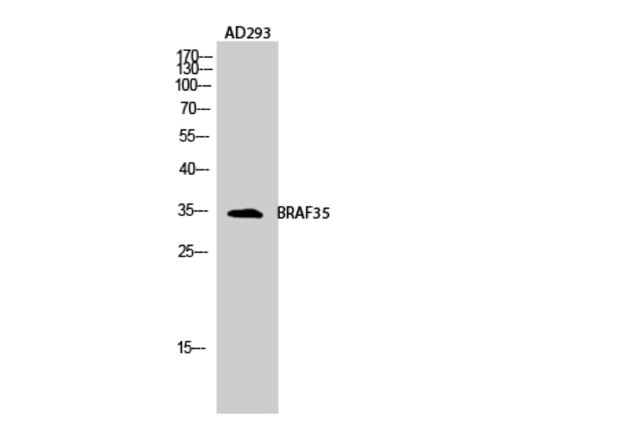 Western Blot - Anti-HMG20B Antibody (C11798) - Antibodies.com