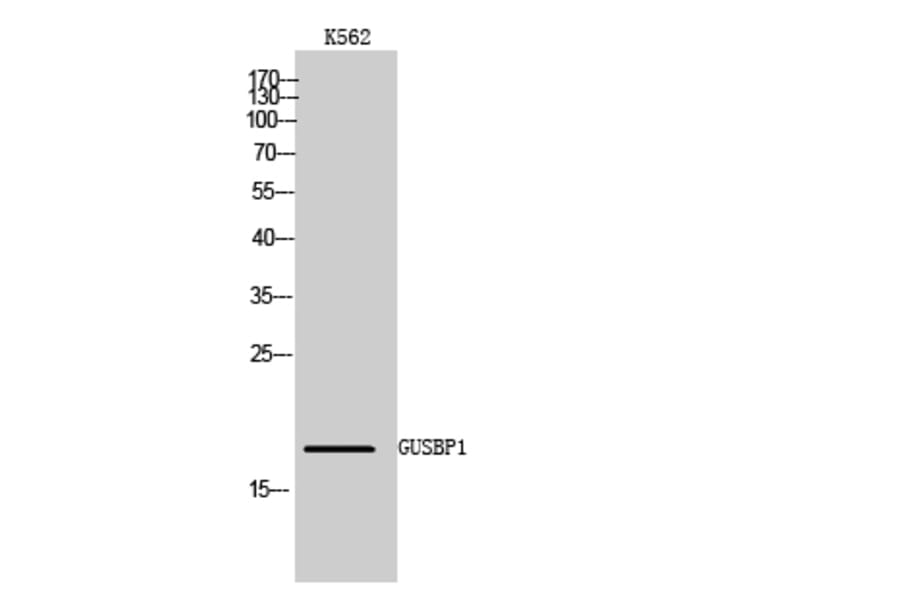 Western Blot - Anti-GUSBL1 Antibody (C14736) - Antibodies.com