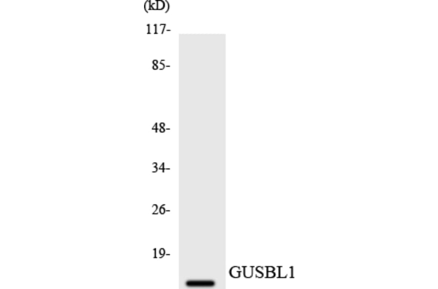 Western Blot - Anti-GUSBL1 Antibody (R12-2864) - Antibodies.com