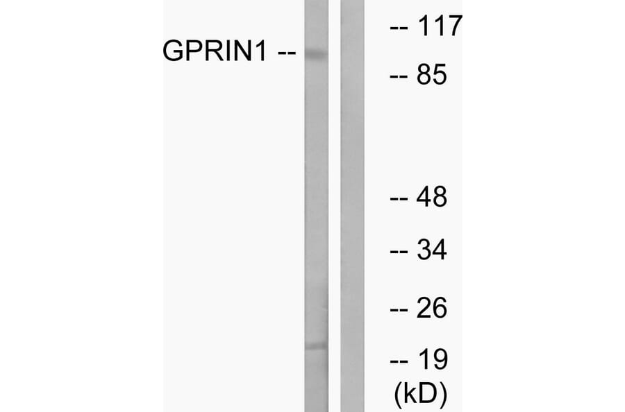 Western Blot - Anti-GPRIN1 Antibody (C15835) - Antibodies.com