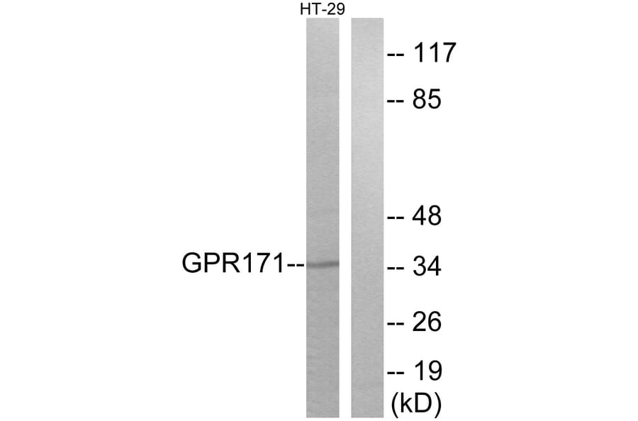 Western Blot - Anti-GPR171 Antibody (G310) - Antibodies.com