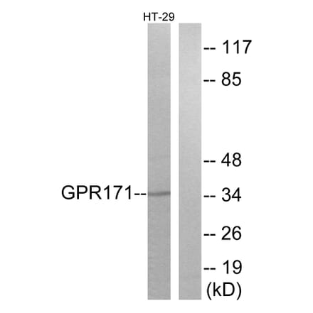 Western Blot - Anti-GPR171 Antibody (G310) - Antibodies.com