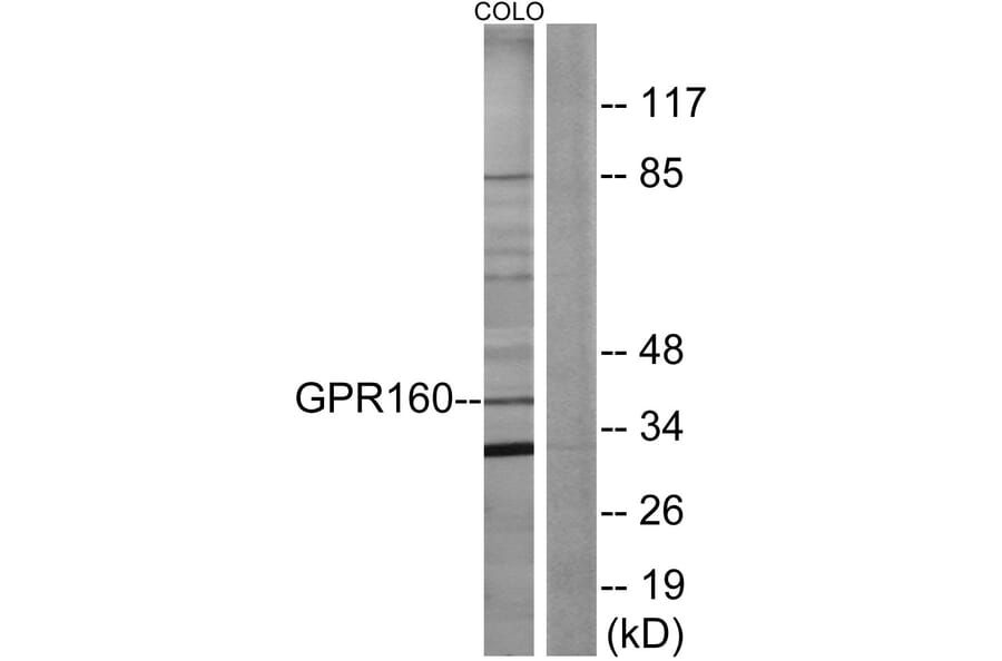 Western Blot - Anti-GPR160 Antibody (G140) - Antibodies.com