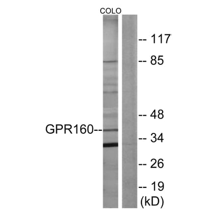 Western Blot - Anti-GPR160 Antibody (G140) - Antibodies.com