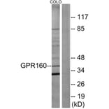 Western Blot - Anti-GPR160 Antibody (G140) - Antibodies.com
