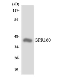 Western Blot - Anti-GPR160 Antibody (R12-2837) - Antibodies.com