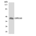 Western Blot - Anti-GPR160 Antibody (R12-2837) - Antibodies.com