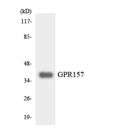 Western Blot - Anti-GPR157 Antibody (R12-2835) - Antibodies.com