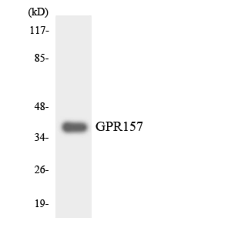 Western Blot - Anti-GPR157 Antibody (R12-2835) - Antibodies.com