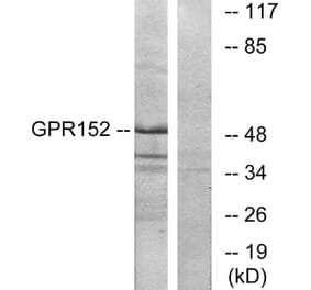 Western Blot - Anti-GPR152 Antibody (G138) - Antibodies.com