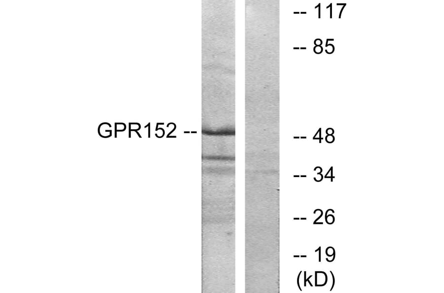 Western Blot - Anti-GPR152 Antibody (G138) - Antibodies.com