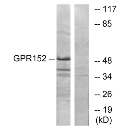 Western Blot - Anti-GPR152 Antibody (G138) - Antibodies.com