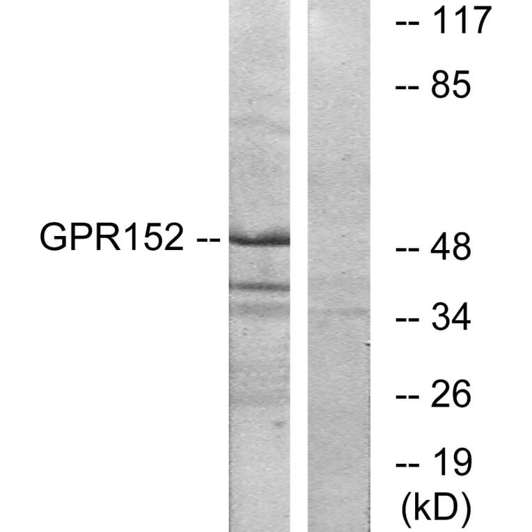 Western Blot - Anti-GPR152 Antibody (G138) - Antibodies.com