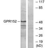 Western Blot - Anti-GPR152 Antibody (G138) - Antibodies.com