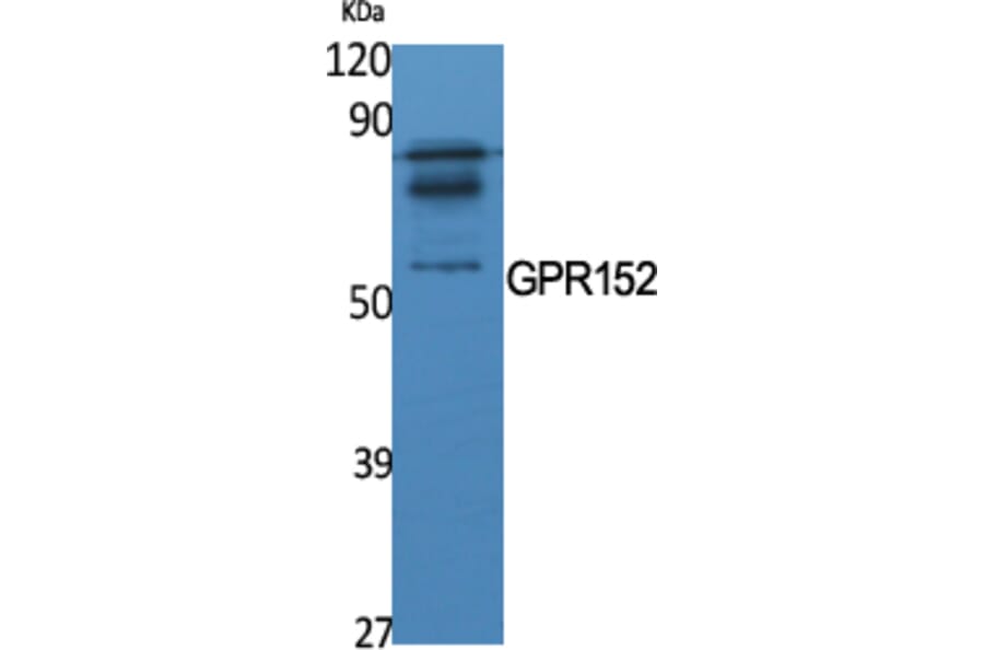 Western Blot - Anti-GPR152 Antibody (G138) - Antibodies.com