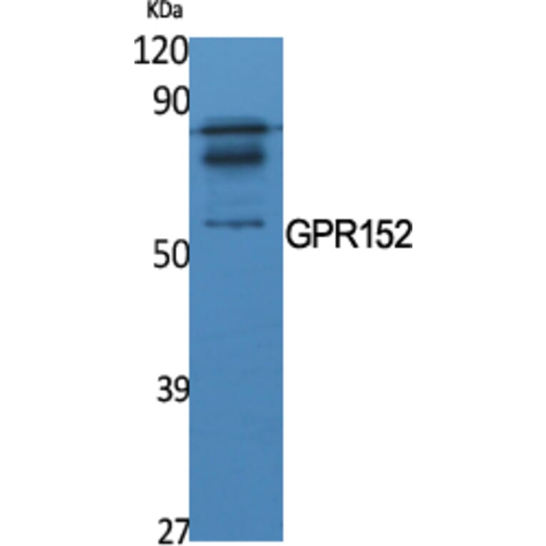 Western Blot - Anti-GPR152 Antibody (G138) - Antibodies.com