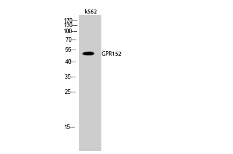 Western Blot - Anti-GPR152 Antibody (G138) - Antibodies.com