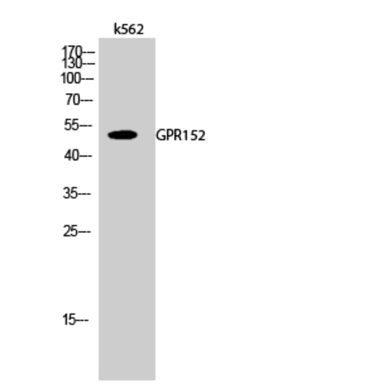 Western Blot - Anti-GPR152 Antibody (G138) - Antibodies.com