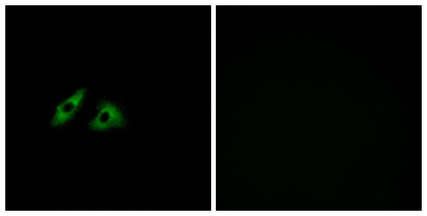 Immunofluorescence analysis of HeLa cells using Anti-GPR152 Antibody. The right hand panel represents a negative control, where the antibody was pre-incubated with the immunising peptide.