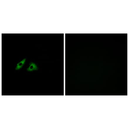 Immunofluorescence - Anti-GPR152 Antibody (G303) - Antibodies.com