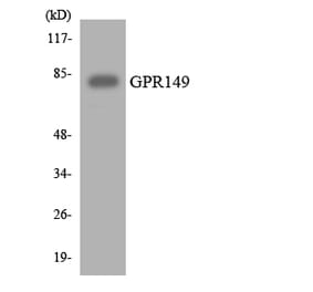 Western Blot - Anti-GPR149 Antibody (R12-2831) - Antibodies.com