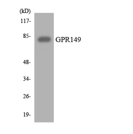 Western Blot - Anti-GPR149 Antibody (R12-2831) - Antibodies.com