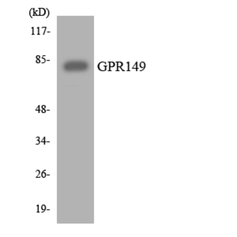 Western Blot - Anti-GPR149 Antibody (R12-2831) - Antibodies.com