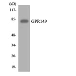 Western Blot - Anti-GPR149 Antibody (R12-2831) - Antibodies.com