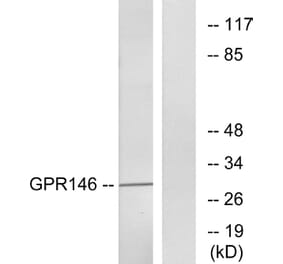Western Blot - Anti-GPR146 Antibody (G299) - Antibodies.com