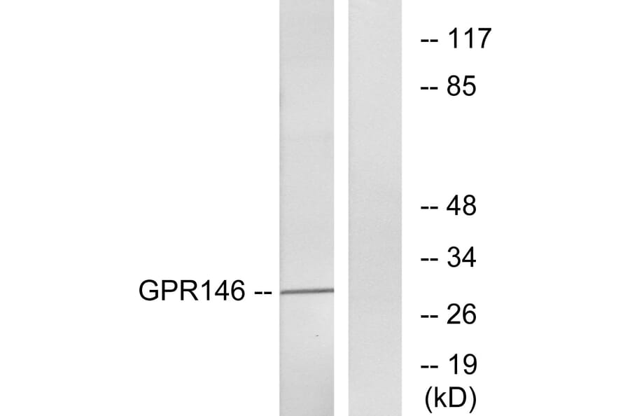 Western Blot - Anti-GPR146 Antibody (G299) - Antibodies.com