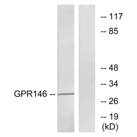 Western Blot - Anti-GPR146 Antibody (G299) - Antibodies.com