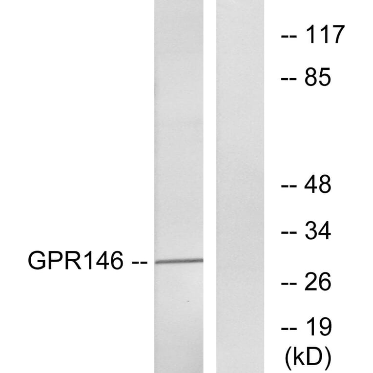 Western Blot - Anti-GPR146 Antibody (G299) - Antibodies.com