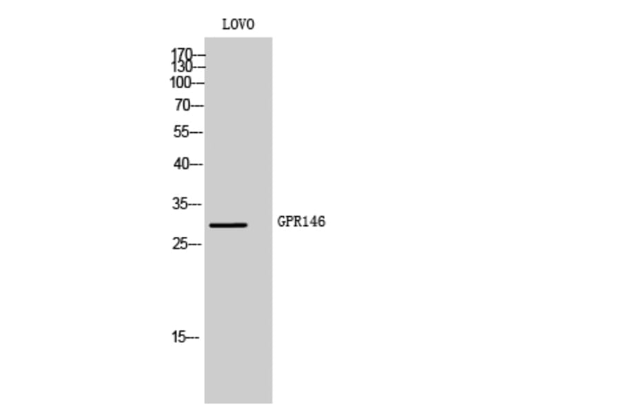 Western Blot - Anti-GPR146 Antibody (G299) - Antibodies.com