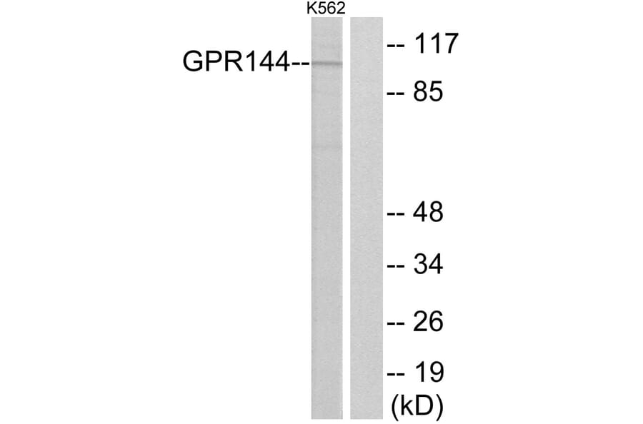 Western Blot - Anti-GPR144 Antibody (G298) - Antibodies.com