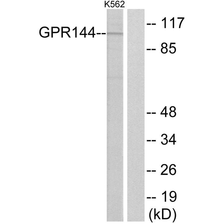 Western Blot - Anti-GPR144 Antibody (G298) - Antibodies.com