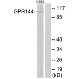 Western Blot - Anti-GPR144 Antibody (G298) - Antibodies.com