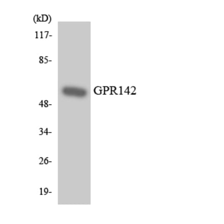 Western Blot - Anti-GPR142 Antibody (R12-2830) - Antibodies.com