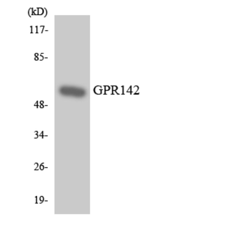 Western Blot - Anti-GPR142 Antibody (R12-2830) - Antibodies.com