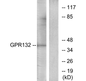 Western Blot - Anti-GPR132 Antibody (G291) - Antibodies.com