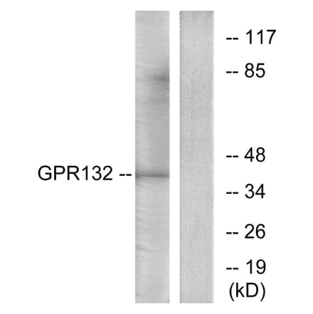 Western Blot - Anti-GPR132 Antibody (G291) - Antibodies.com