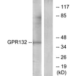 Western Blot - Anti-GPR132 Antibody (G291) - Antibodies.com
