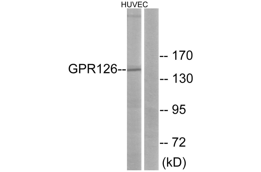 Western Blot - Anti-GPR126 Antibody (G290) - Antibodies.com