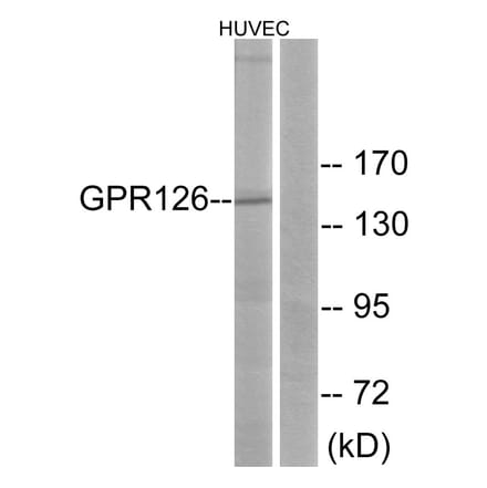 Western Blot - Anti-GPR126 Antibody (G290) - Antibodies.com